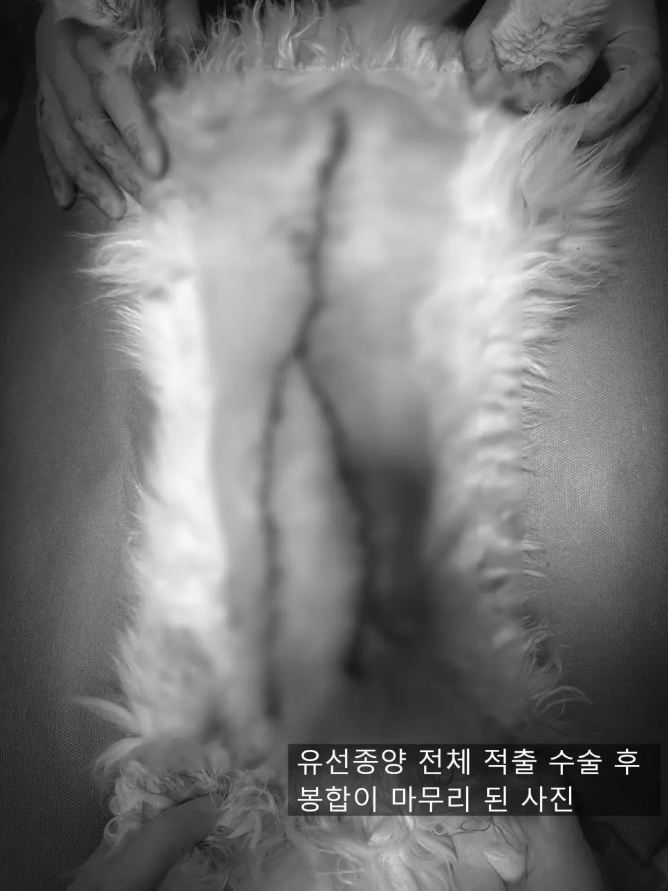 봉합을 마친 배입니다. 가슴 아래에서 사타구니까지 한 줄로 이어집니다.