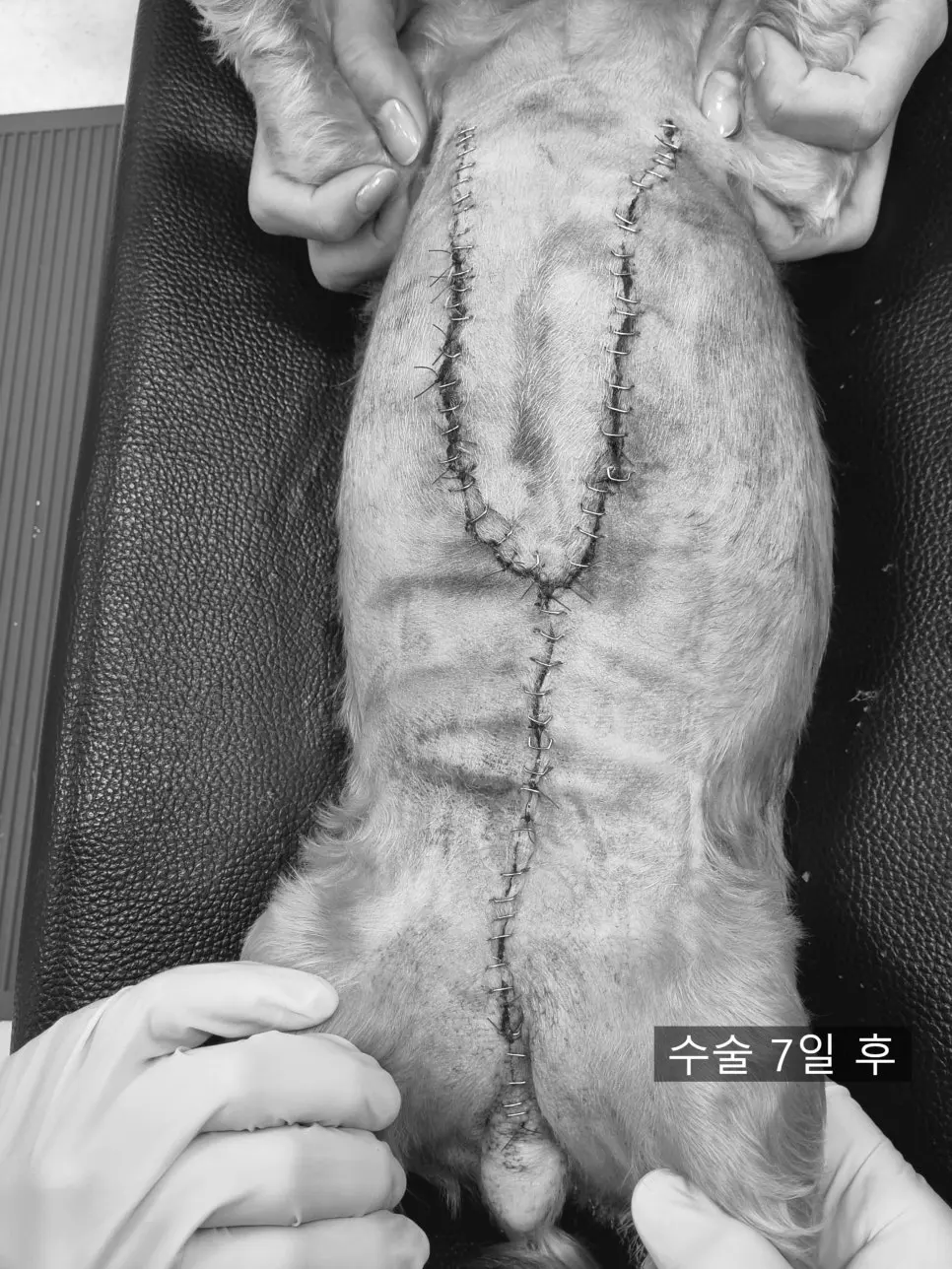 수술 7일째 봉합 부위입니다