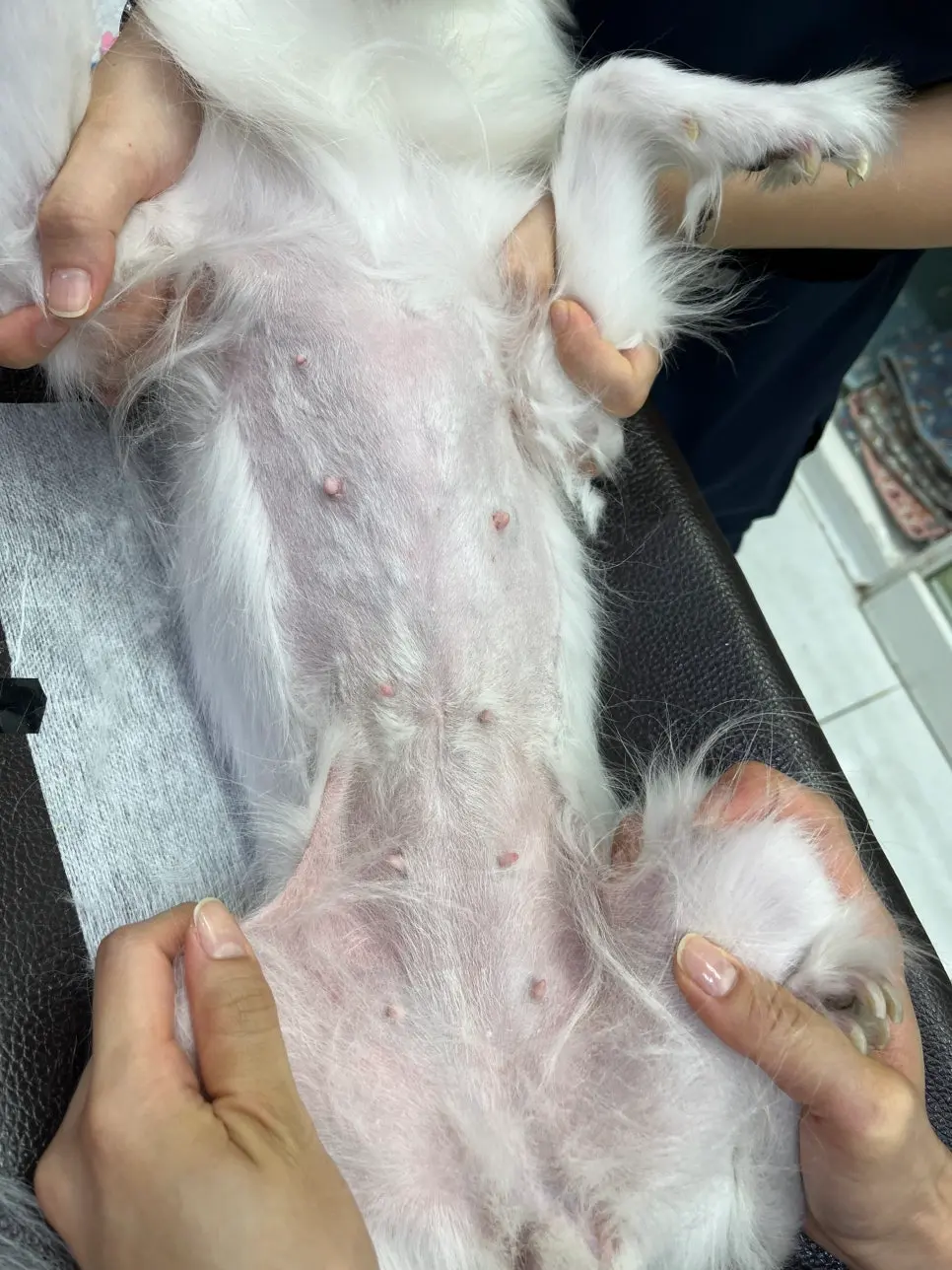 복부 유선 라인에서 확인된 종괴