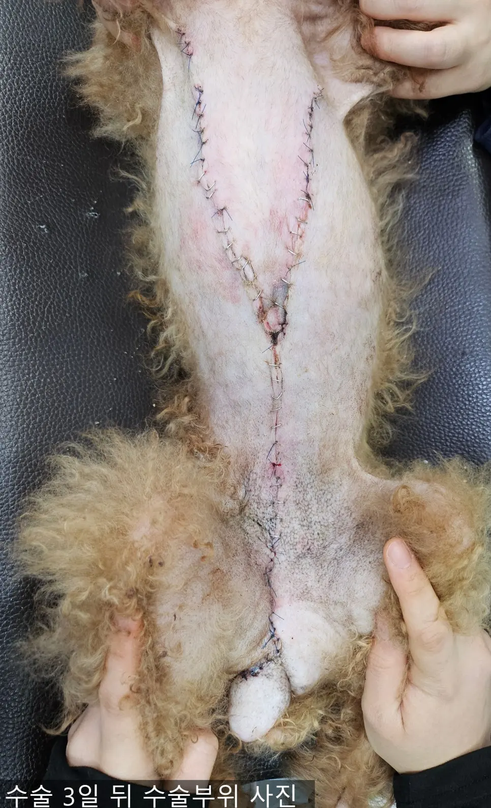 수술 사흘 뒤. 붉은 기와 붓기가 가라앉았다