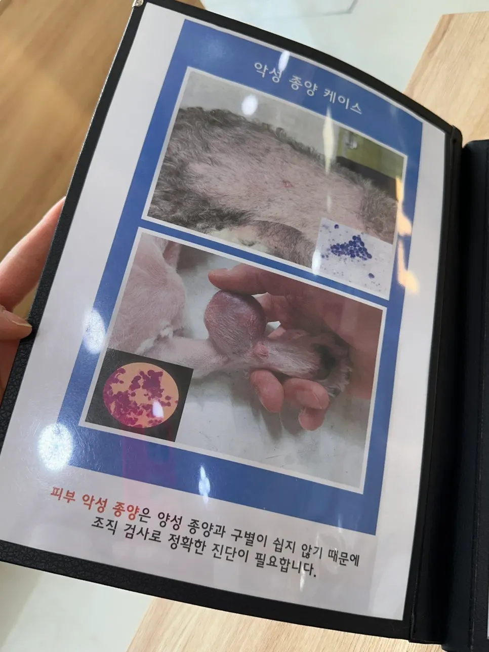 상담 때 함께 보는 종양 사례 자료