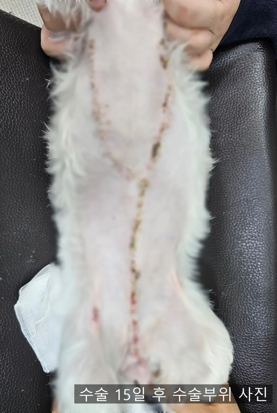 수술 보름 뒤. 남아 있던 실을 모두 뽑았습니다