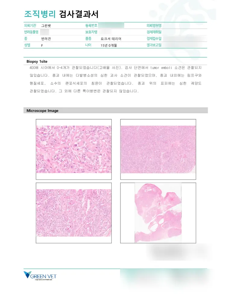 현미경으로 본 유선 종괴 조직