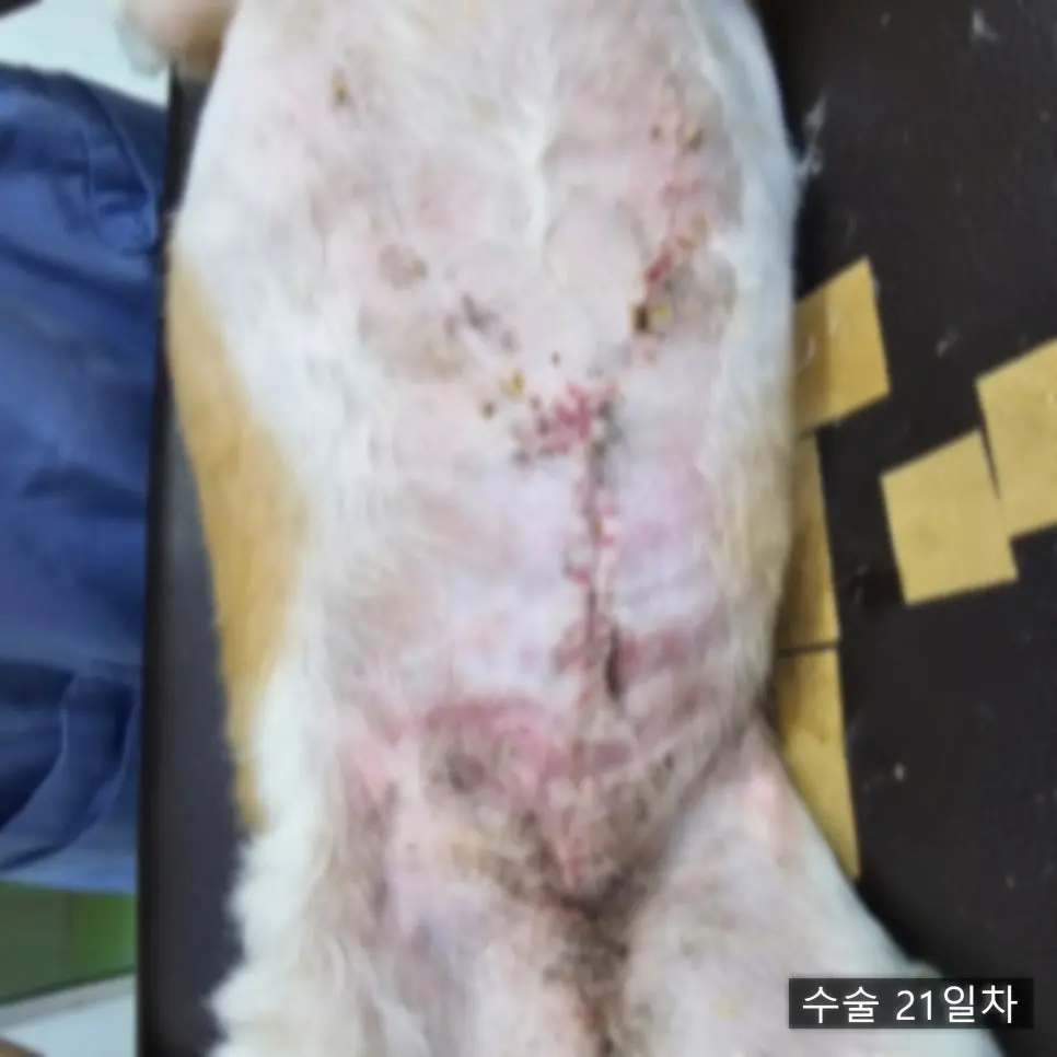 수술 21일 후 수술 부위