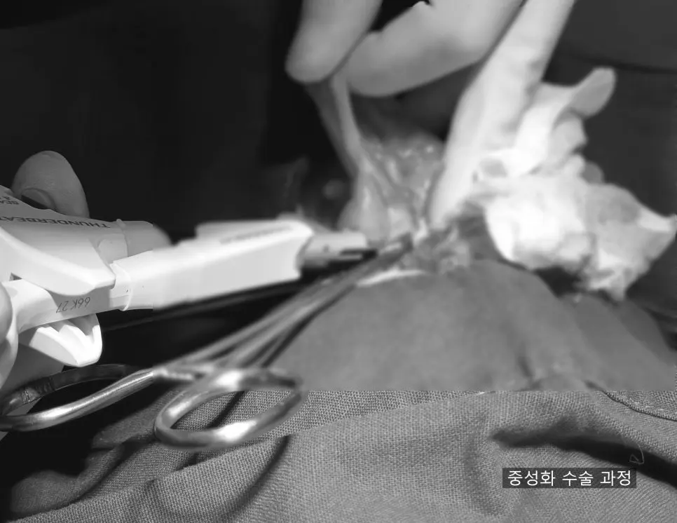절제 범위를 확인하며 이어 간 수술 장면