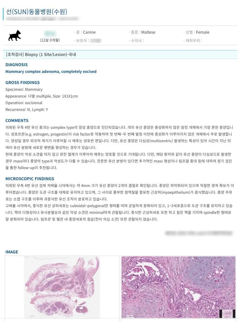 조직검사 결과지. 오른쪽 4번 젖샘 종괴는 양성으로 판정되었습니다