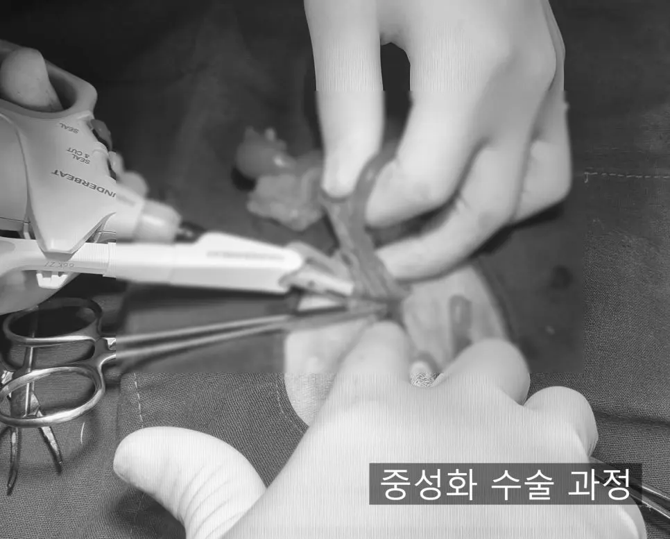 혈관을 처리하는 모습