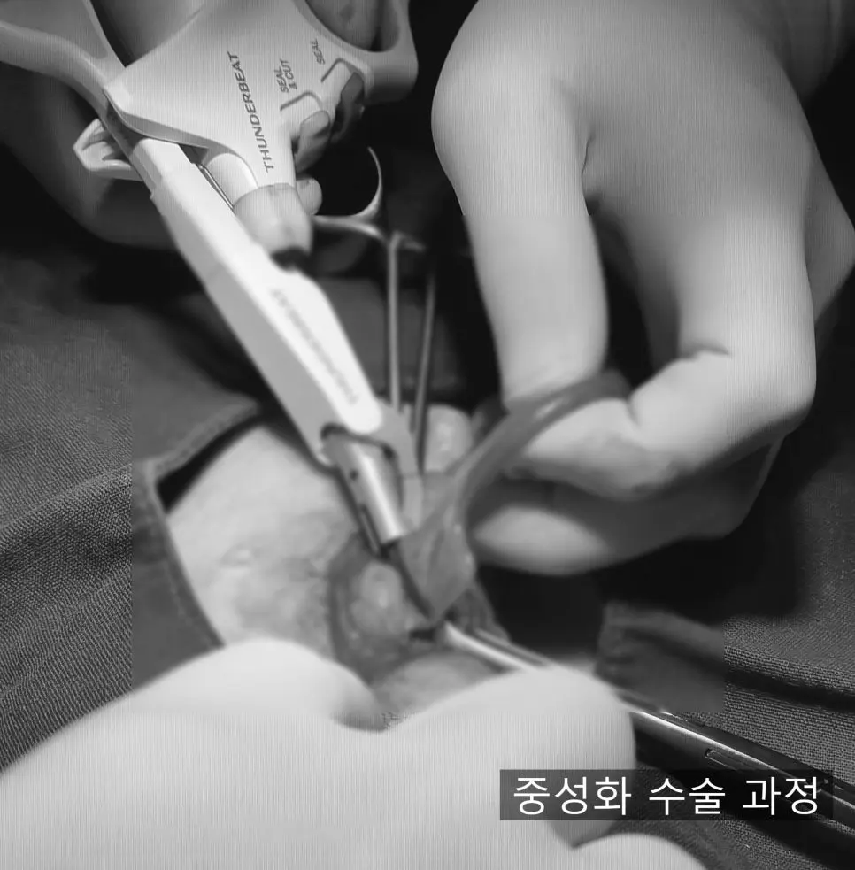 썬더비트 손잡이가 보이는 수술 장면