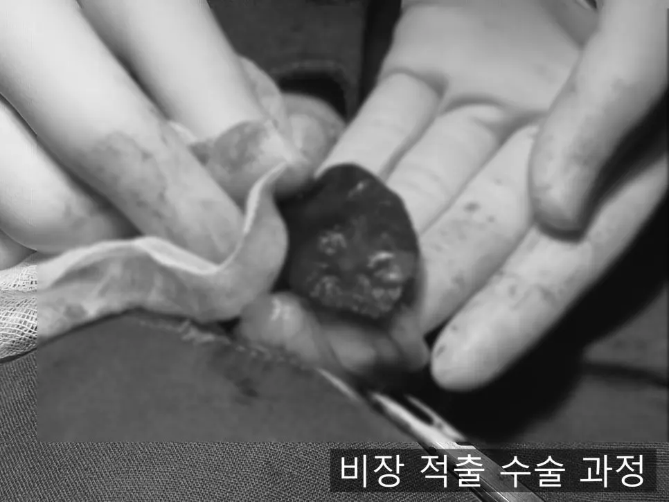 비장을 떼어내는 과정