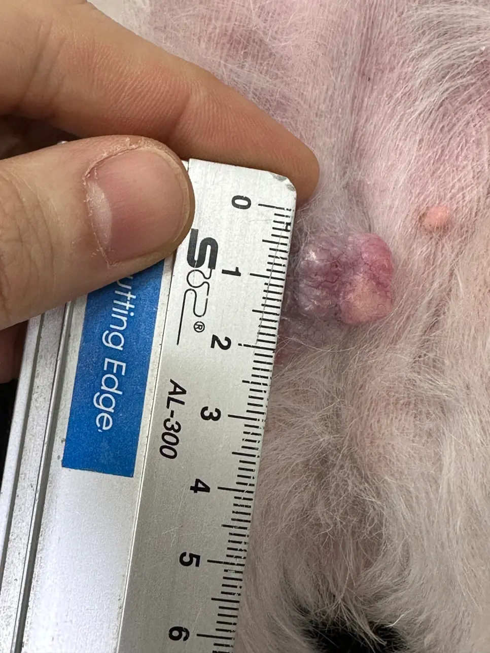 자를 대고 종괴의 크기를 기록했습니다