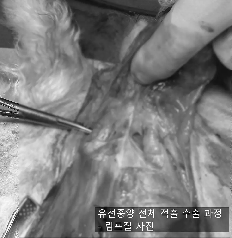 종괴가 자리한 유선을 넓게 들어냅니다