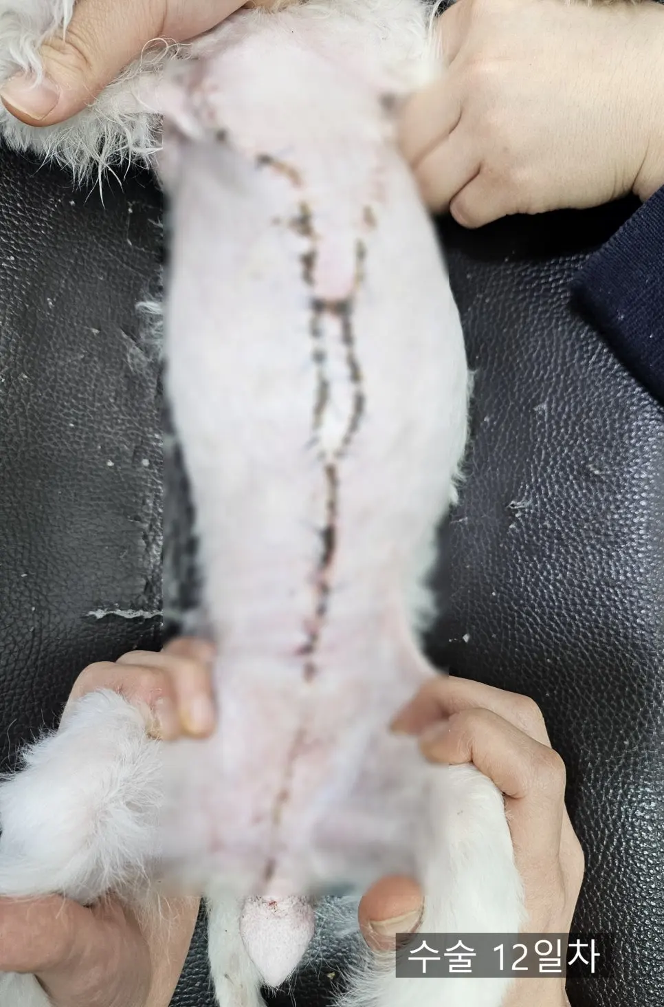날짜가 지나며 붓기가 가라앉습니다