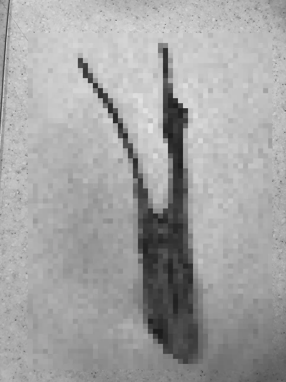 떼어낸 유선 조직은 따로 담아 검사실로 보내 성질을 확인합니다.
