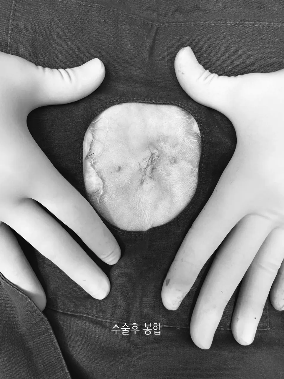 봉합을 마친 절개선