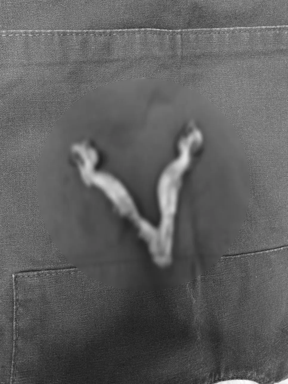 몸 밖으로 꺼낸 난소와 자궁